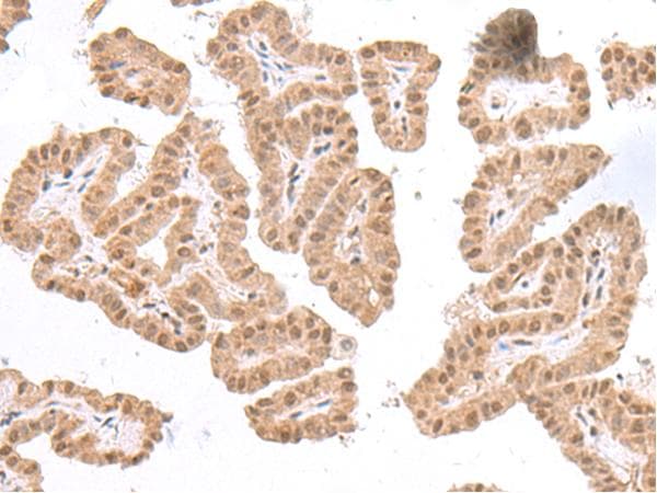 TDP2 / TTRAP Antibody