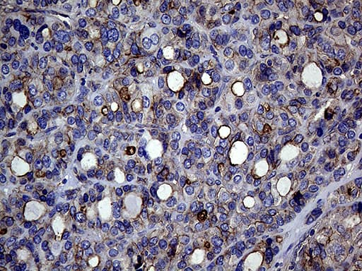 GNAS Antibody (clone OTI7A6)