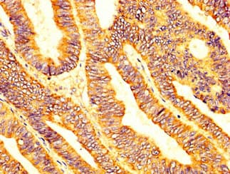Polyclonal Rabbit anti-Human LPCAT2 Antibody (IHC, WB)