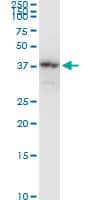 NAGK Antibody (clone 1H8)