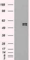 KRT8 / CK8 / Cytokeratin 8 Antibody (clone OTI2E4)