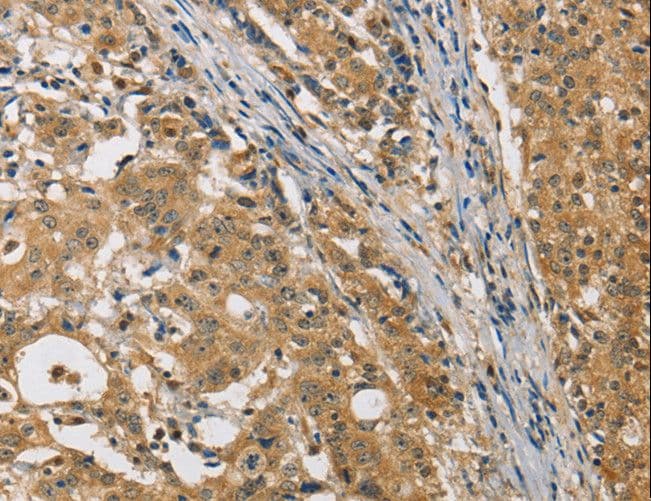 MIP / AQP0 / Aquaporin 0 Antibody