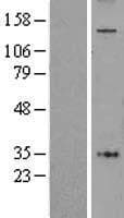 AF5Q31 / AFF4 Protein (Over-Expression Lysate Myc-DDK (Flag))