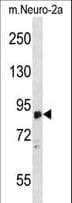 ZDHHC8 Antibody (aa532-561)