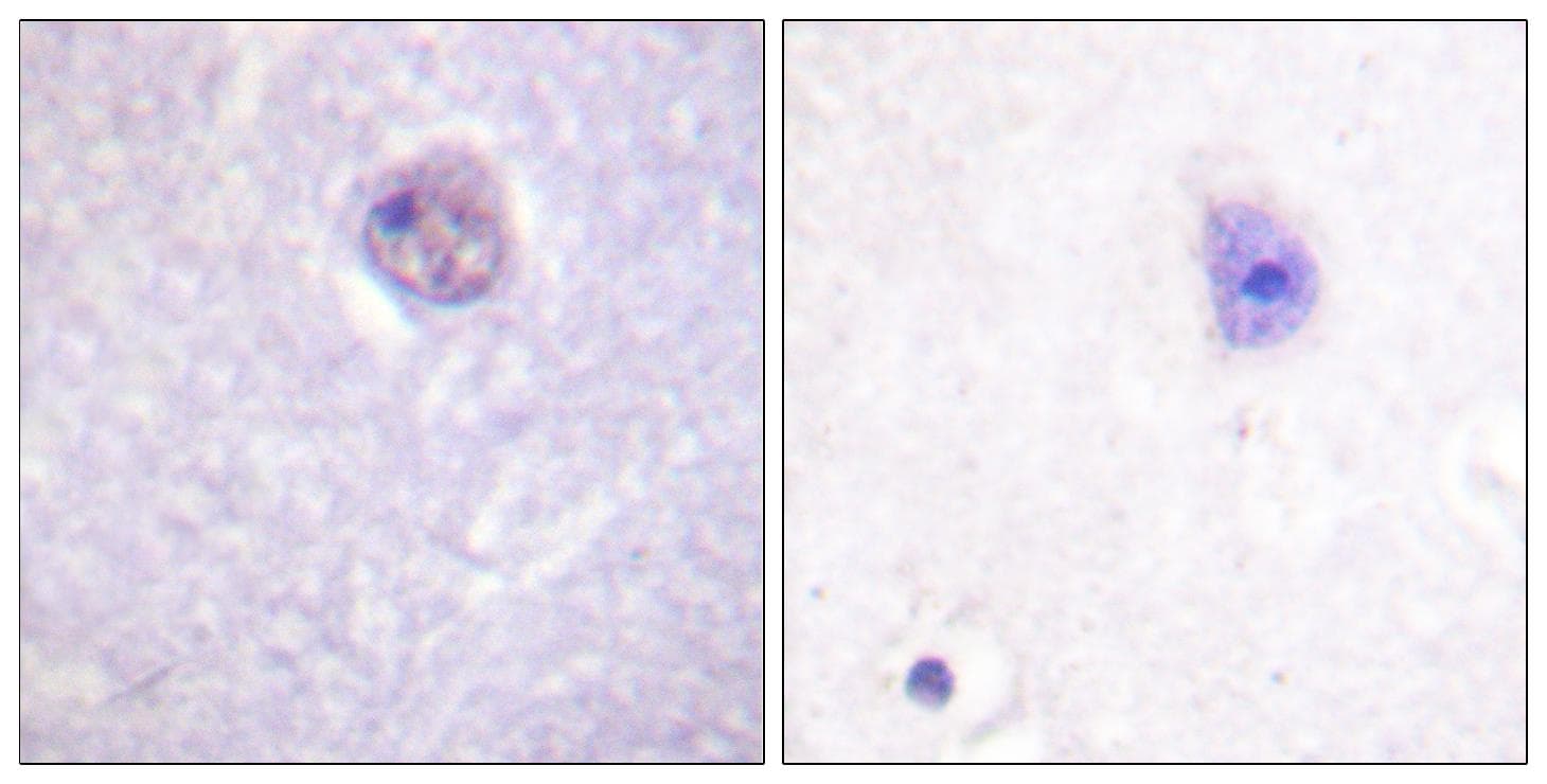 SOX9 Antibody (phospho-Ser181)