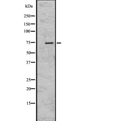 Polyclonal Rabbit anti-Human HSET / KIFC1 Antibody (IHC, IF, WB)