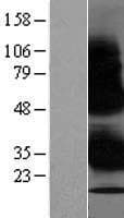 WBP1 Protein (Over-Expression Lysate Myc-DDK (Flag))
