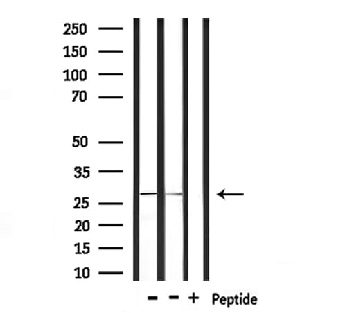 FCGR3A / CD16A Antibody