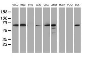 METTL16 / METT10D Antibody (clone OTI3B5)