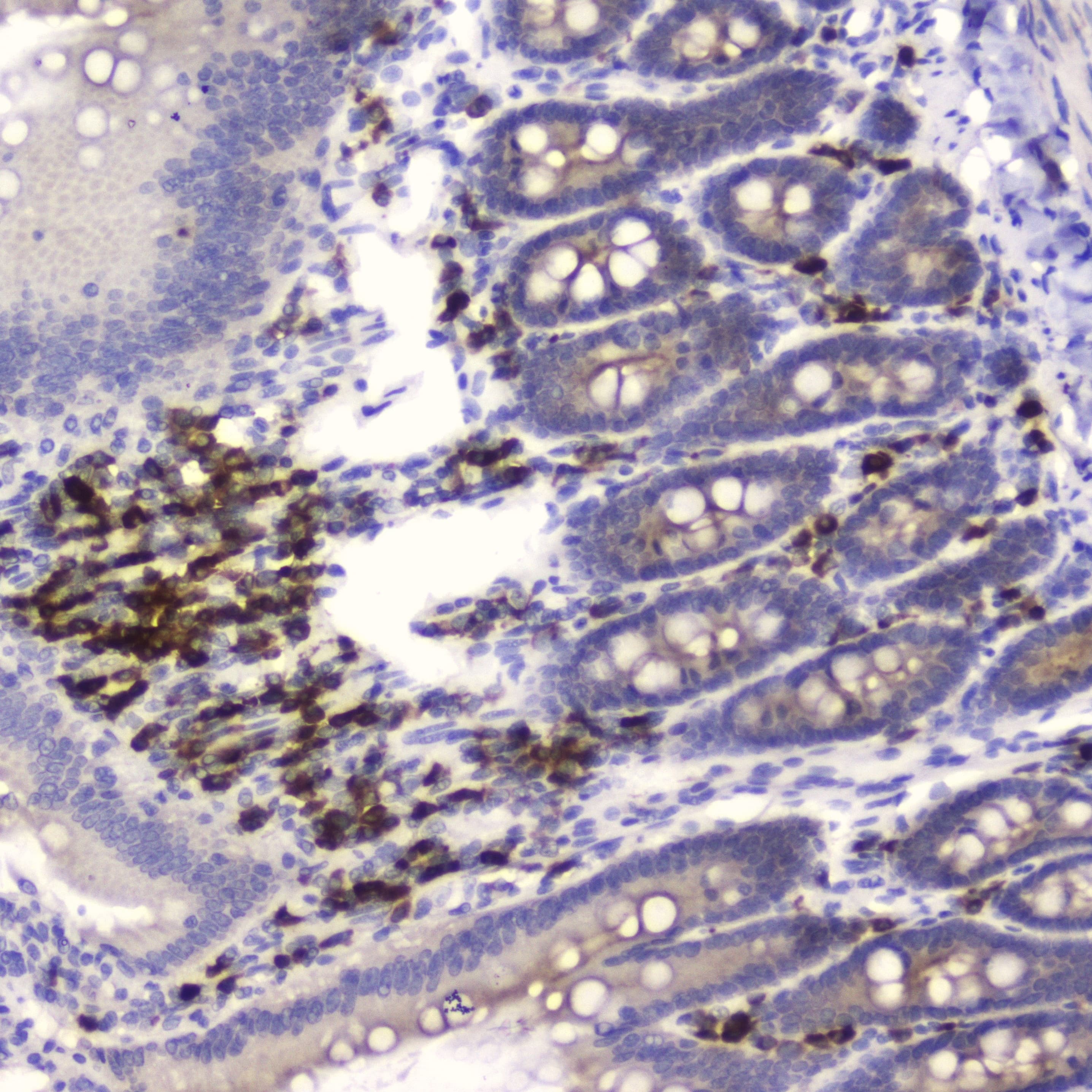 WFDC2 / HE4 Antibody