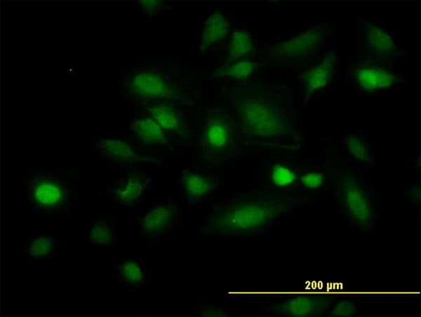 IHC-plus™ STAT5B Antibody (clone 5D6)
