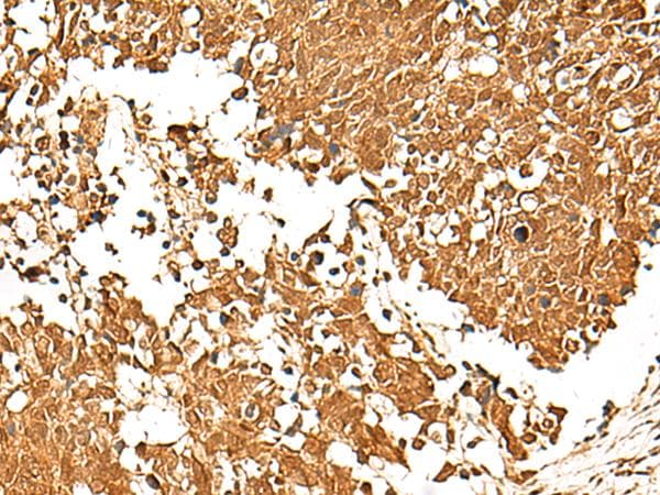 Polyclonal Rabbit anti-Human TCF7 Antibody (IHC)