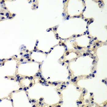 PNKP Antibody