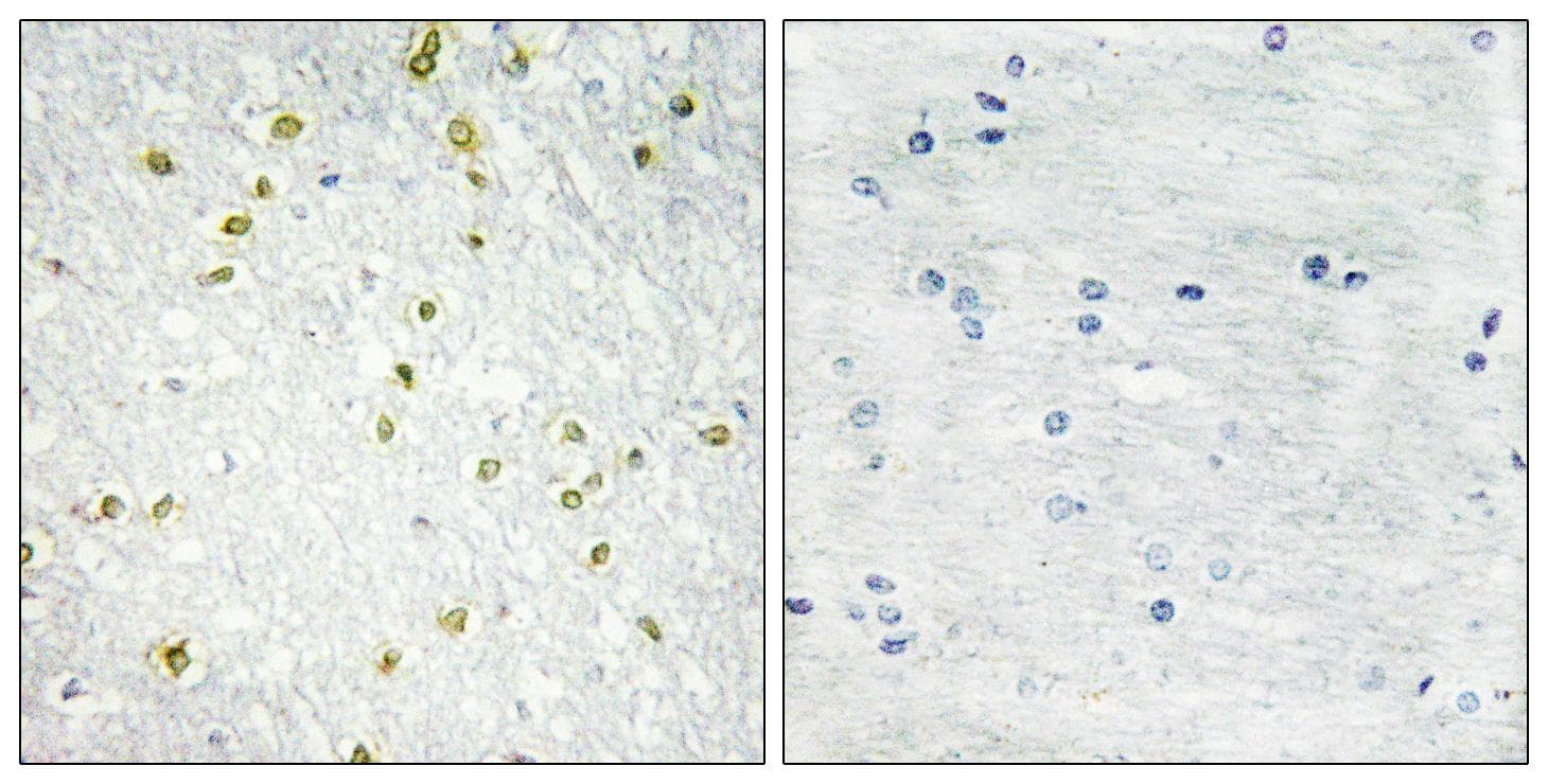 Polyclonal Rabbit anti-Human SNAPC5 Antibody (IHC)