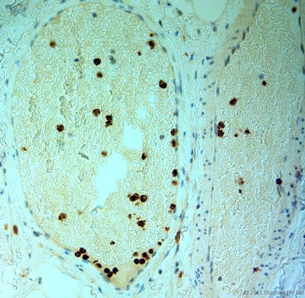 MPO / Myeloperoxidase Antibody