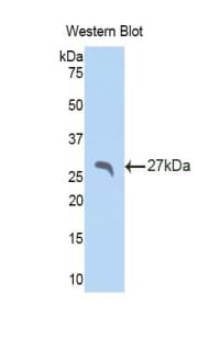 APCS / Serum Amyloid P / SAP Antibody (aa22-222)