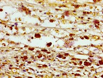 SEPT3 / Septin 3 Antibody