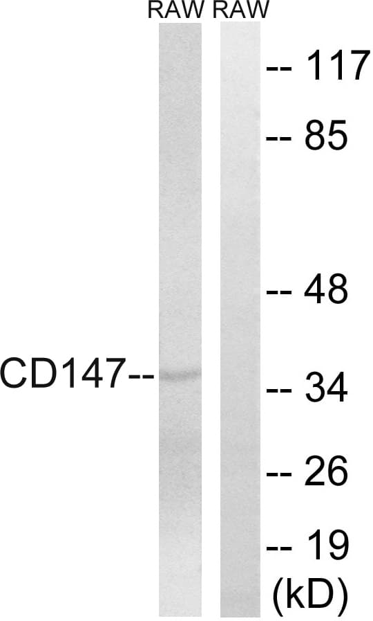 Basigin / Emmprin / CD147 Antibody (aa336-385)