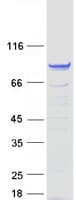 Human FSIP1 Protein (Recombinant Myc-DDK (Flag))