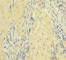FASLG / Fas Ligand Antibody (aa103-281)