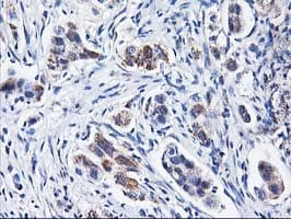 HARS2 Antibody (clone OTI2D6)