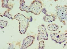 Polyclonal Rabbit anti-Human PIAS1 Antibody (aa422-651, IHC)