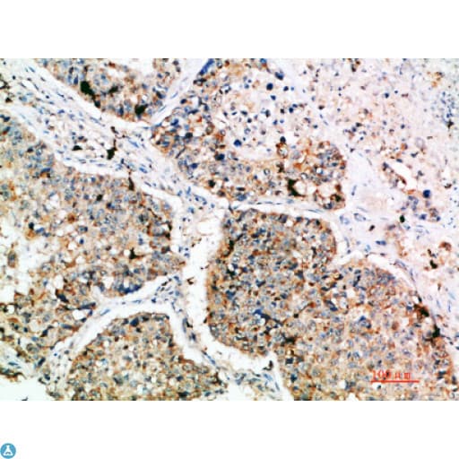 LAMP3 / CD208 Antibody
