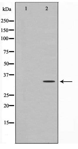 MCL1 / MCL 1 Antibody