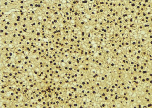Polyclonal Rabbit anti-Human Angiogenin / ANG Antibody (IHC, WB)