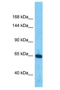 BMP1 Antibody (aa420-469)