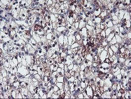 ERBB2 / HER2 Antibody (aa676-1255, clone OTI4G10, Carrier-free)