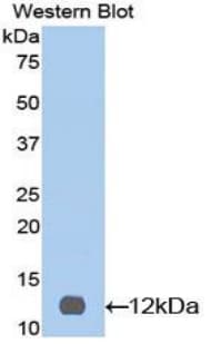 IL12RB2 Antibody (aa559-647)