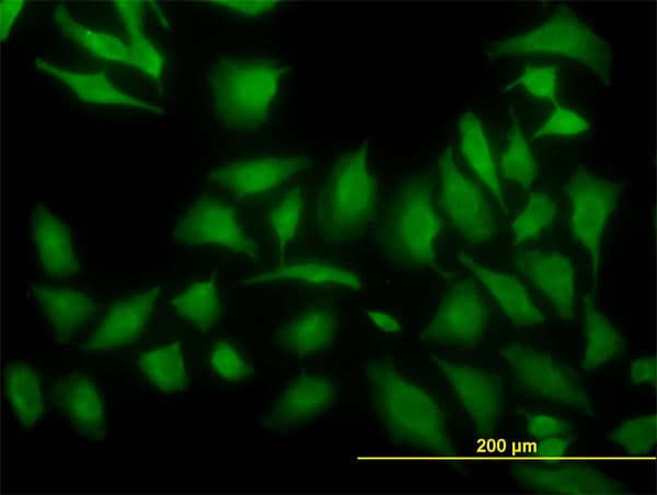 Monoclonal Mouse anti-Human ARF5 Antibody (clone 1B4, IF, WB)