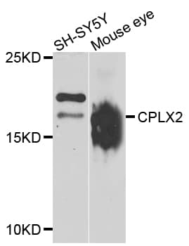 CPLX2 / Complexin 2 Antibody