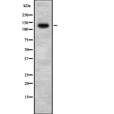 HIPK2 Antibody