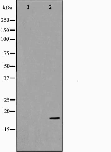 Polyclonal Rabbit anti-Human TP53I11 / PIG11 Antibody (IHC, IF, WB)