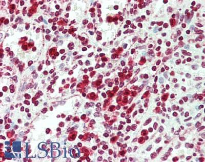 IHC-plus™ NR4A1 / NUR77 Antibody