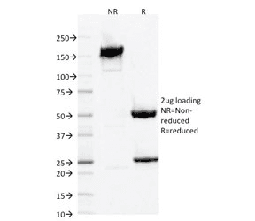AIF1 / IBA1 Antibody (clone AIF1/1909)