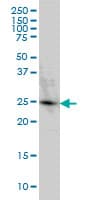 IHC-plus™ PGRMC2 Antibody (clone 3C11)
