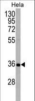 IHC-plus™ Polyclonal Rabbit anti-Human APG5 / ATG5 Antibody (aa1-30, IHC, IF, WB)