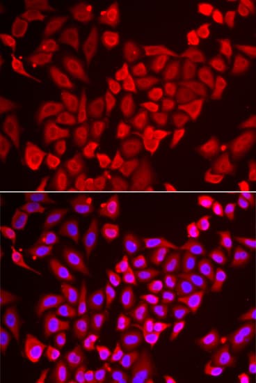 TP-2 / TNP2 Antibody