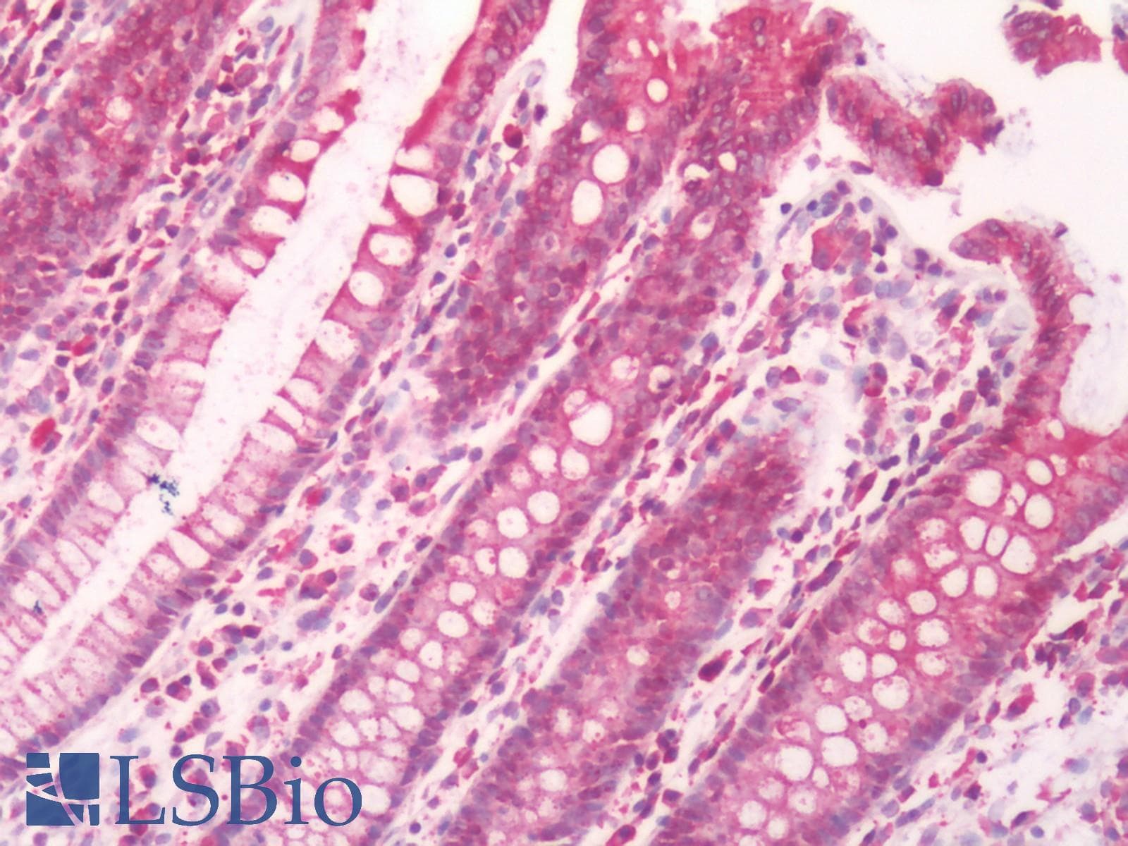 IHC-plus™ Polyclonal Rabbit anti-Human RAIG2 / GPRC5B Antibody (C-Terminus, IHC)