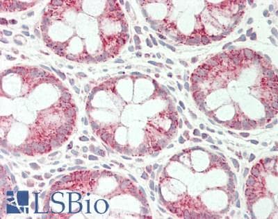 SPINT1 / HAI-1 Antibody (aa168-217)
