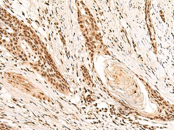 Polyclonal Rabbit anti-Human RMND5B Antibody (IHC)