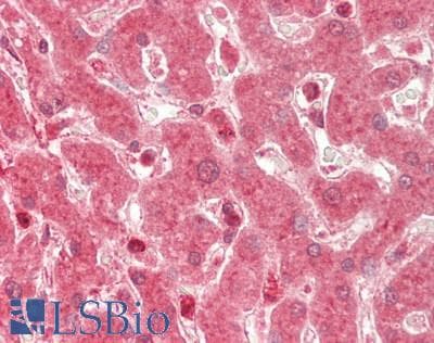 Polyclonal Rabbit anti-Human ALAS1 Antibody (aa146-195, IHC, WB)