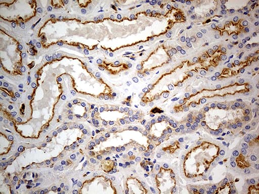 Monoclonal Mouse anti-Human PTH / Parathyroid Hormone Antibody (clone OTI2D3, aa32-115, IHC, WB)