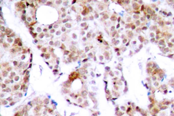 MYC / c-Myc Antibody (phospho-Thr58)