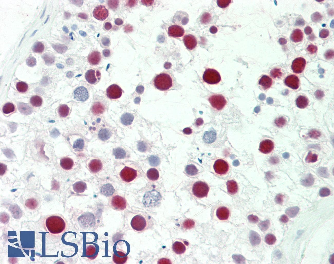 IHC-plus™ Monoclonal Mouse anti-Human MSH6 Antibody (clone 5B11, aa217-395, IHC, WB)