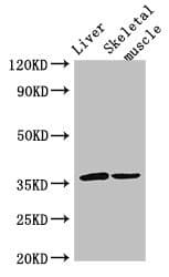 Polyclonal Rabbit anti-Human PGAM5 Antibody (IHC, IF)