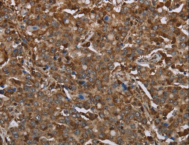 ARHGDIA / RHOGDI Antibody